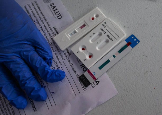 Kasus HIV-Aids di Gianyar Selalu Muncul, 9000 Orang Tes HIV Pertahun