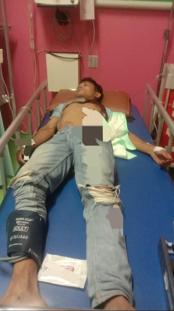 Hanya Gara-Gara Tidak Diberi Kasbon, Tukang Cuci Motor Tusuk Perut Teman