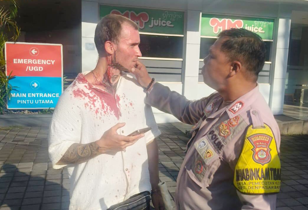 Sedang Treadmill, Pria Denpasar Tiba-tiba Dipukul WNA Prancis di IOWA Gym