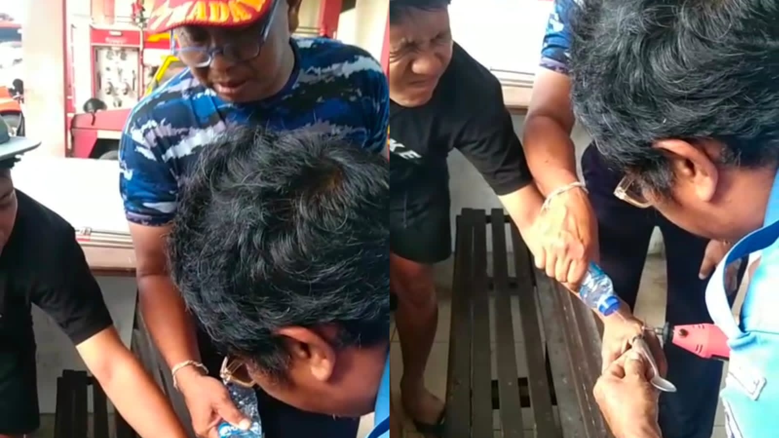 Jari Manis Membengkak, Mahasiswa Asal Sidemen Minta Bantuan Damkar Klungkung Lepas Cincin Alpaka