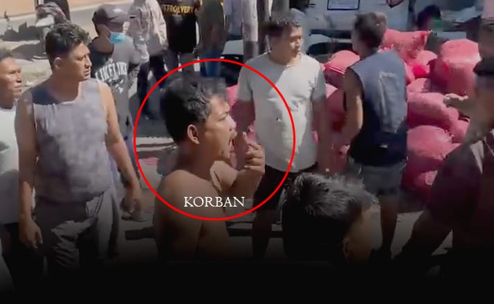 Ditegur Jangan Ngebut, Pemotor Mabuk Tuak Keroyok Buruh Harian di Klungkung hingga Gigi Lepas