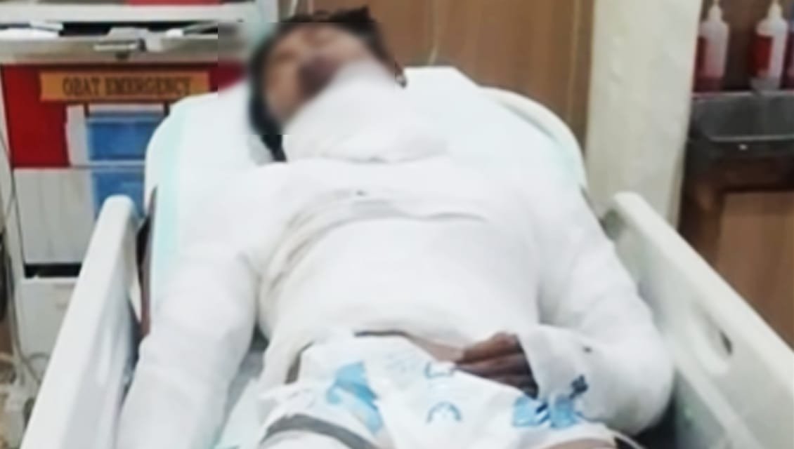 Jadi Tulang Punggung Keluarga, Pemuda Korban Dibakar Bos di Karangasem Kesulitan Biaya Operasi