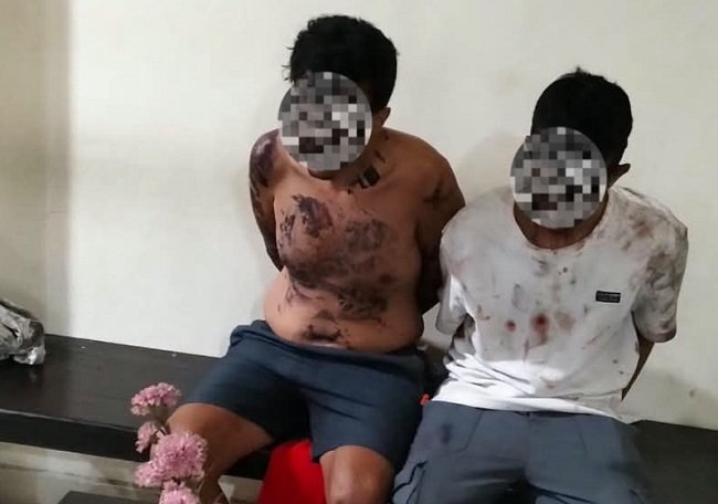 Penusukan Tiga WNI di Depan Club Kuta Selatan,  Dua WNA Diamankan